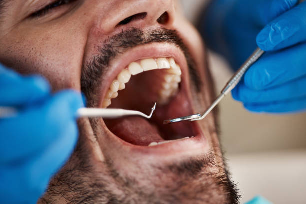 Best Dentist for Severe Toothache  in Lafayette, CA